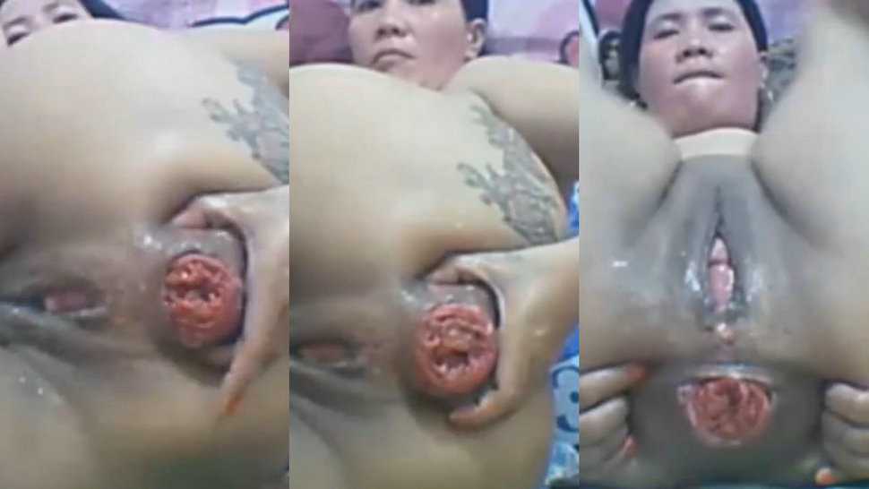 熟女妈妈超重口屁眼拳交①肛门脱肛 肠子都翻出来了 肛门玫瑰大开 废了-变态