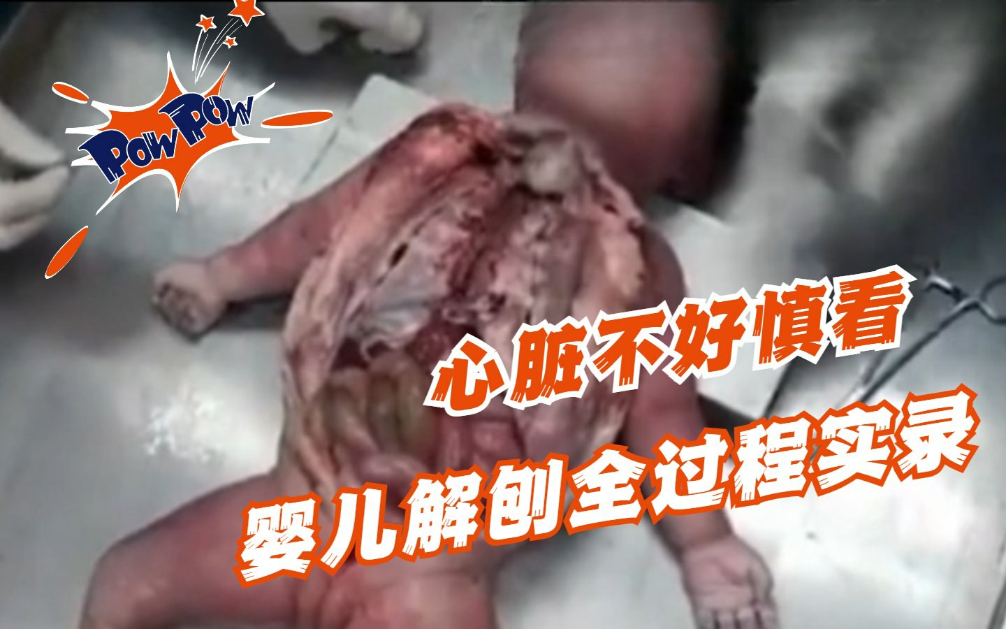 暗网-婴儿解刨全过程实录，心脏不好慎看！-变态