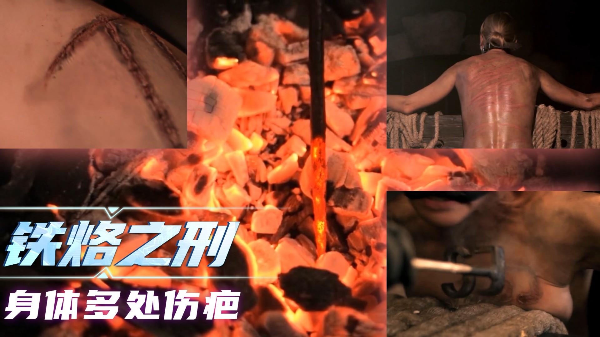 ②铁烙之酷刑，身体多处烫伤，惨无人道