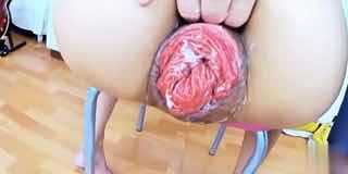 「重口味系列」肛门都外翻了还玩拳交呢-变态