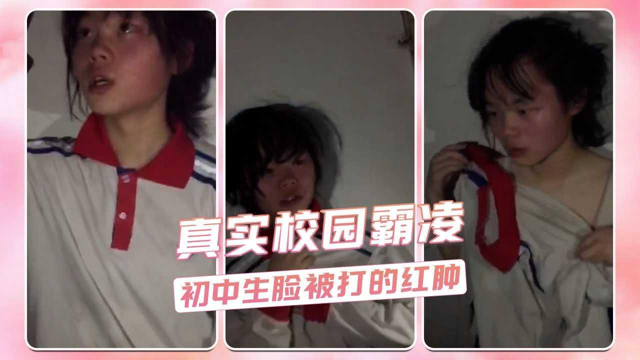 真实校园霸凌  初中生脸被打的红肿