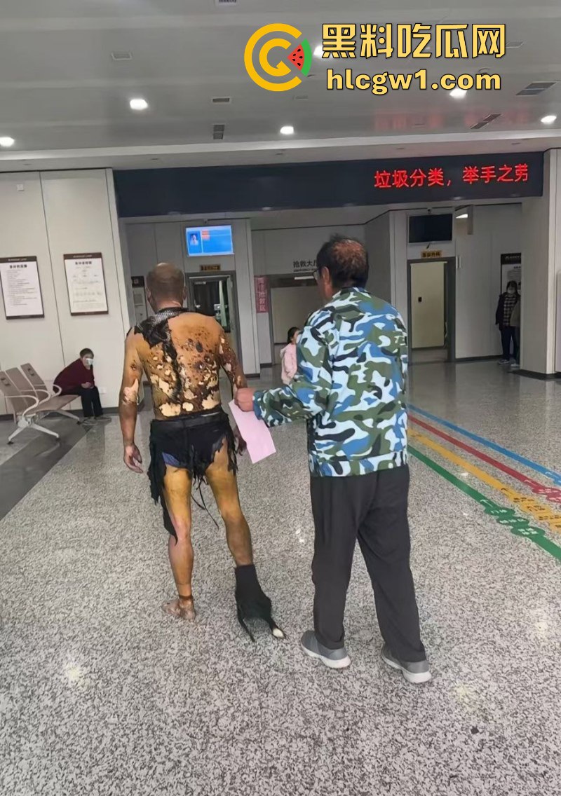 江苏常州易化工厂油罐爆炸 现场员工大面积烧伤 场面骇人 现场视频曝光皮都烧掉了