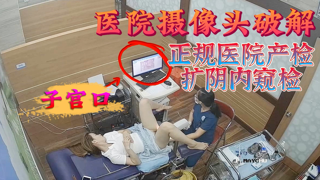 摄像头破解-正规医院产检扩阴内窥检