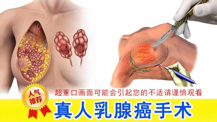 【超重口预警】乳腺癌切除手术 1-变态