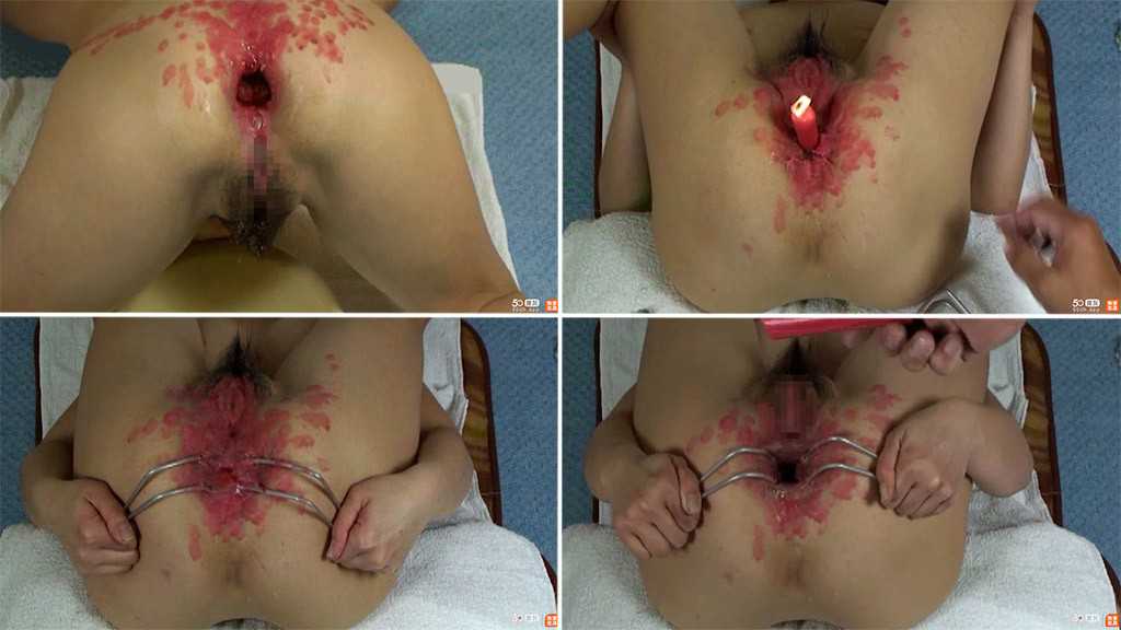 重口味塞苹果滴蜡 滴蜡灌肠-变态